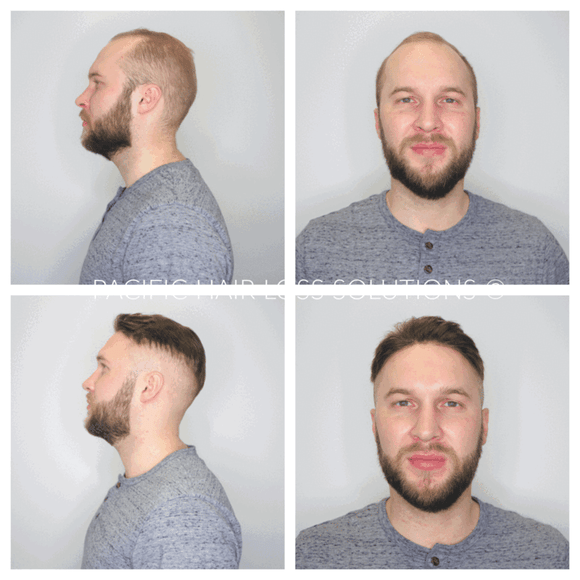 8*6'' men's installation package - natural colour
